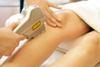 Dùng dịch vụ triệt lông vĩnh viễn khuyến mãi có tốt không - Thiết bị điện